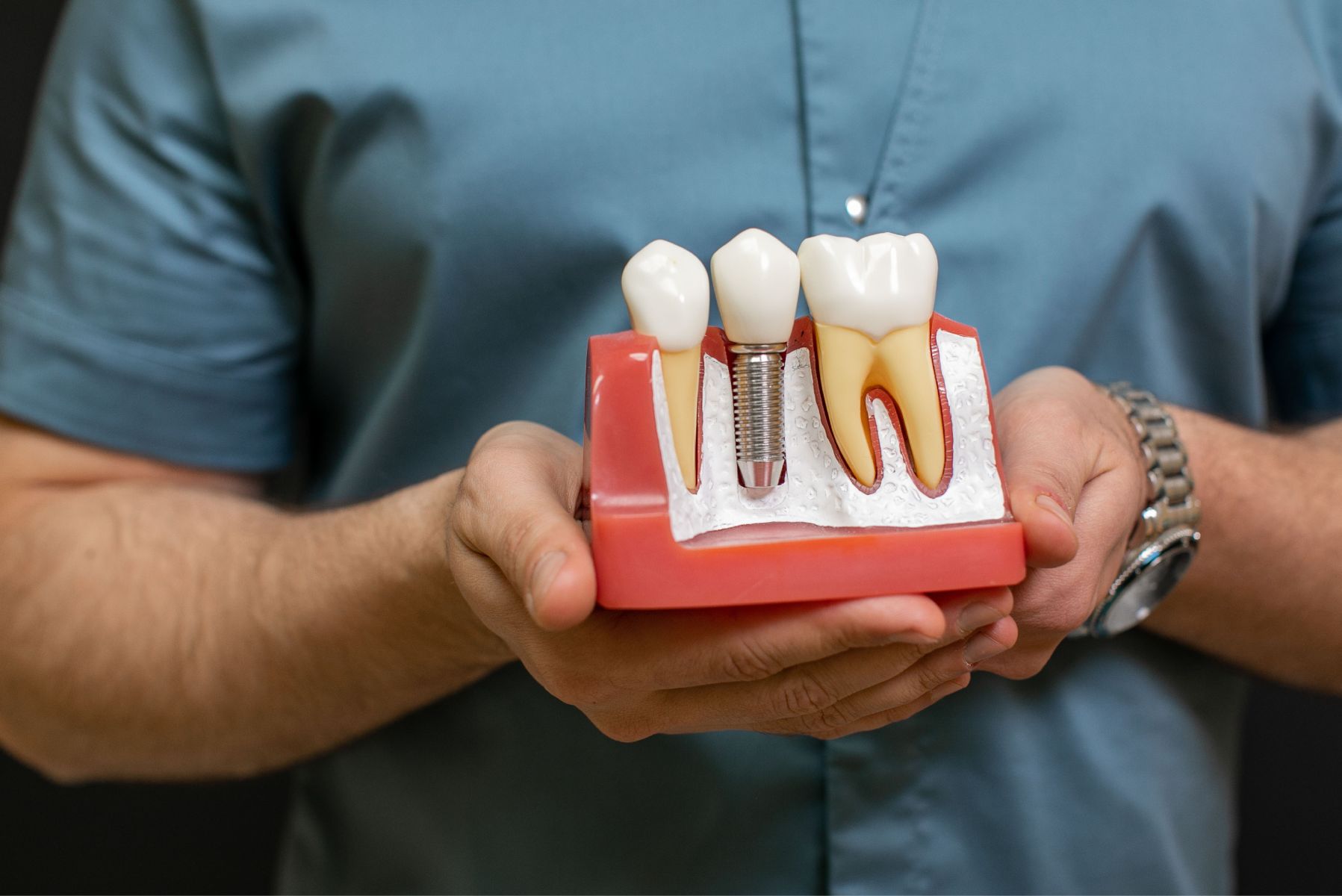 Periodontoloji Atölyesi: CBCT Üzerinde Kemik İçi Dental İmplant Planlaması