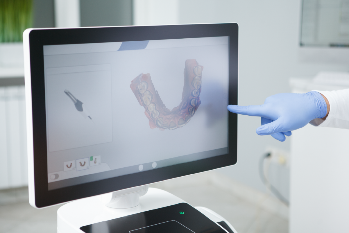 Ortodonti Atölyesi Ağız İçi Tarayıcı Cihaz Kullanımı