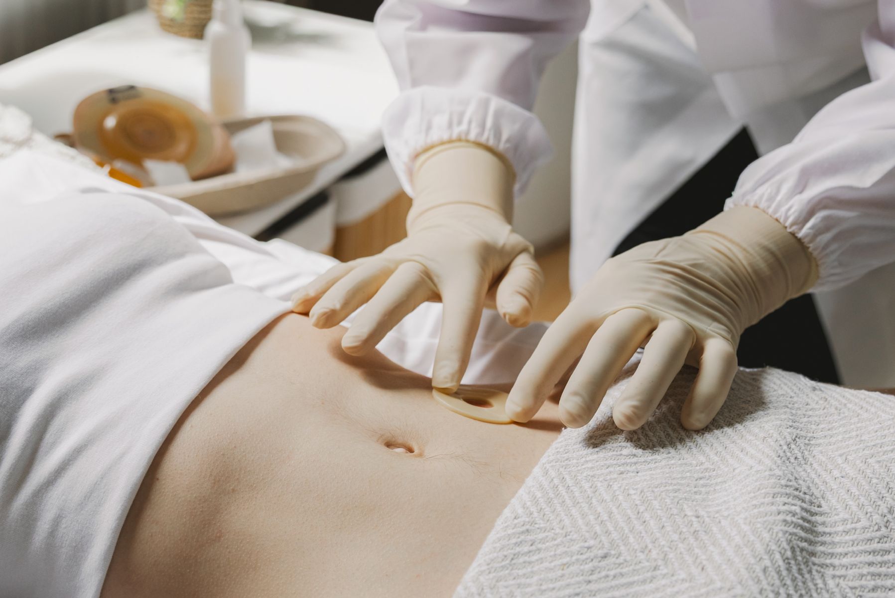 Stoma Kaynaklı Komplikasyonlar ve Yönetimi